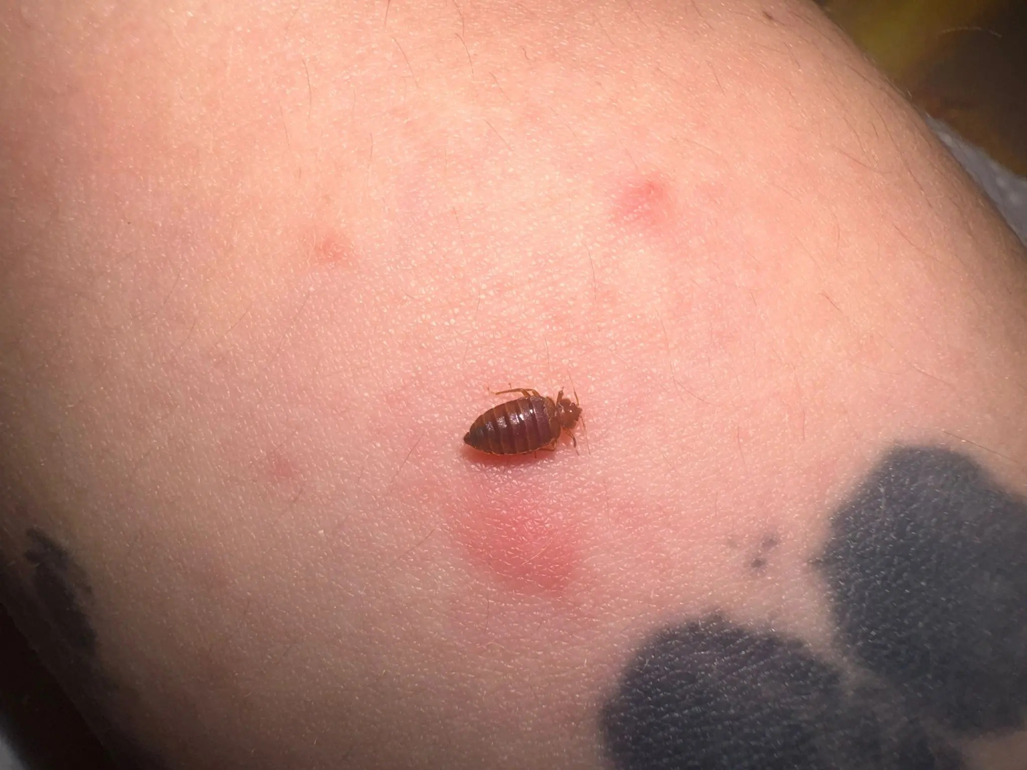 Boutons punaises de lit